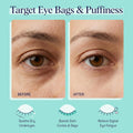 Spalife Cooling Cucumber Eye Pads | Spa Gifts & Korean Dark Circles & Puffy Eyes Treatment | Nourishing Cucumber Eye Pads | Eye Mask For Puffy Eyes Daily Depuffing Eye Patches | 4 Packs Of 12