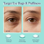Spalife Cooling Cucumber Eye Pads | Spa Gifts & Korean Dark Circles & Puffy Eyes Treatment | Nourishing Cucumber Eye Pads | Eye Mask For Puffy Eyes Daily Depuffing Eye Patches | 4 Packs Of 12