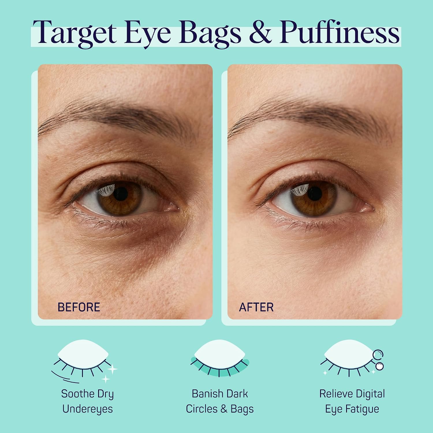Spalife Cooling Cucumber Eye Pads | Spa Gifts & Korean Dark Circles & Puffy Eyes Treatment | Nourishing Cucumber Eye Pads | Eye Mask For Puffy Eyes Daily Depuffing Eye Patches | 4 Packs Of 12