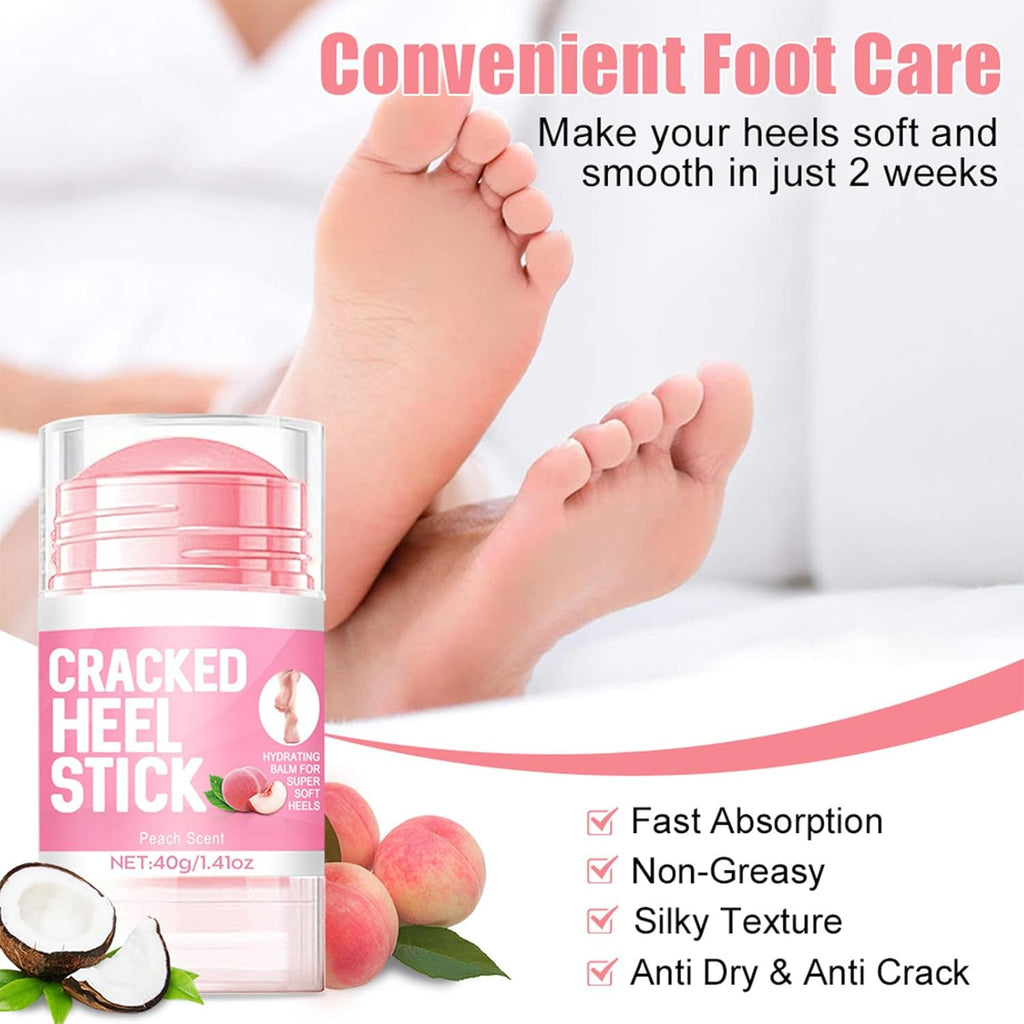 2pcs 60% Urea Hydrating and Anti-Cracking Foot Cream, 2025 Upgraded Moisturising and Relieves Cracking and Dryness Foot Cream for Dry Cracked Feet And Hands（aloe + peach）
