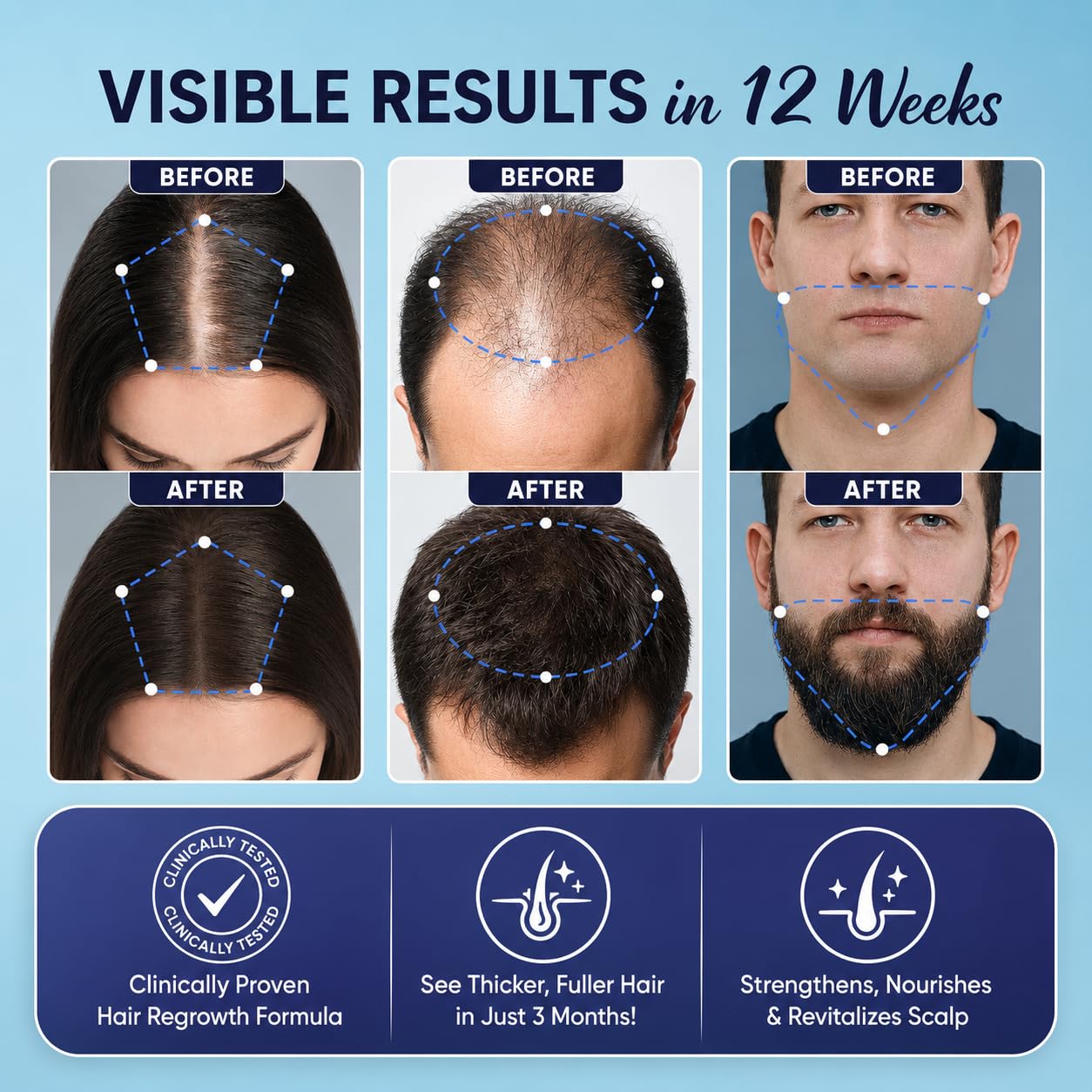 5% Minoxidil For Men And Women Hair Growth: Minoxidil Spray Hair Regrowth Treatment Serum With Biotin & Rosemary -Stop Hair Thinning And Hair Loss For Stronger Thicker Longer Hair 2 Pack