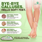 Miracle of Aloe Foot Repair Cream, 32 oz, 60% Pure UltraAloe, Non-Greasy Moisturizer for Dry, Cracked Feet and Callused Skin, Fast-Absorbing Deep Hydration, Diabetic Safe, Peppermint Scent