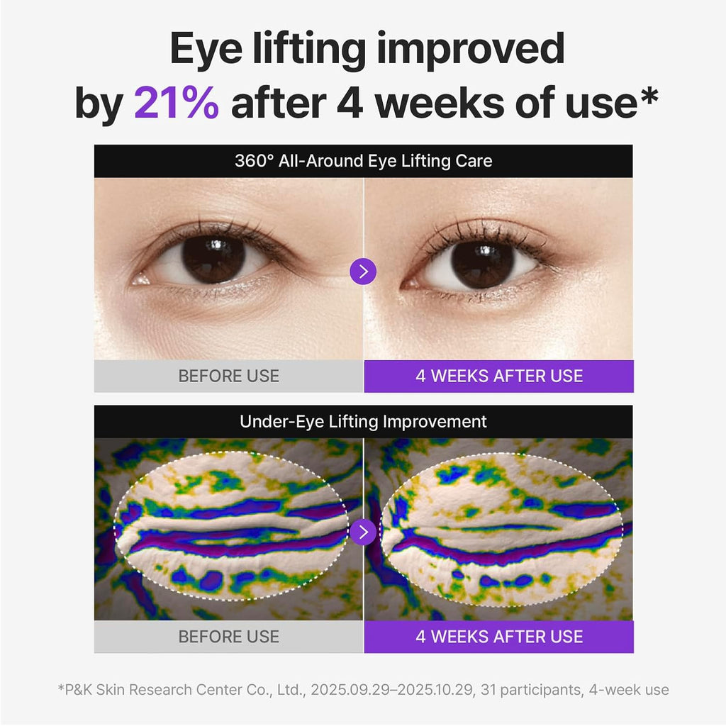 Centellian 24 360º Shot Pdrn Eye Cream - Anti-Aging Retinol Eye Cream With Teca, Collagen, Firming & Wrinkle Smoothing, Hydrating Care For Dark Circles, Under-Eye Bags & Crow'S Feet, 1.01 Fl Oz