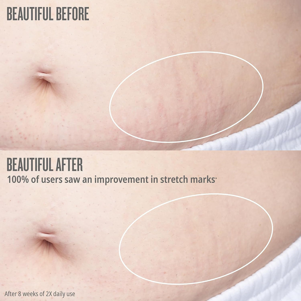 Sol De Janeiro Bum Bum Firmeza Body Oil - Stretch Mark Oil