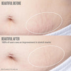 Sol De Janeiro Bum Bum Firmeza Body Oil - Stretch Mark Oil