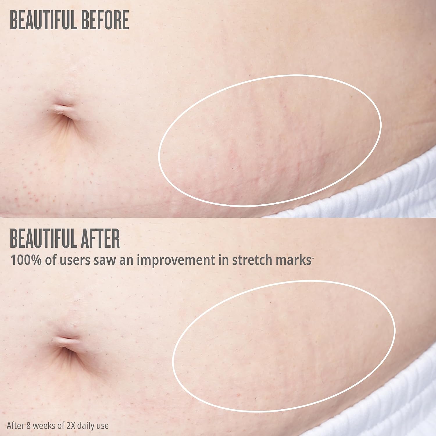 Sol De Janeiro Bum Bum Firmeza Body Oil - Stretch Mark Oil