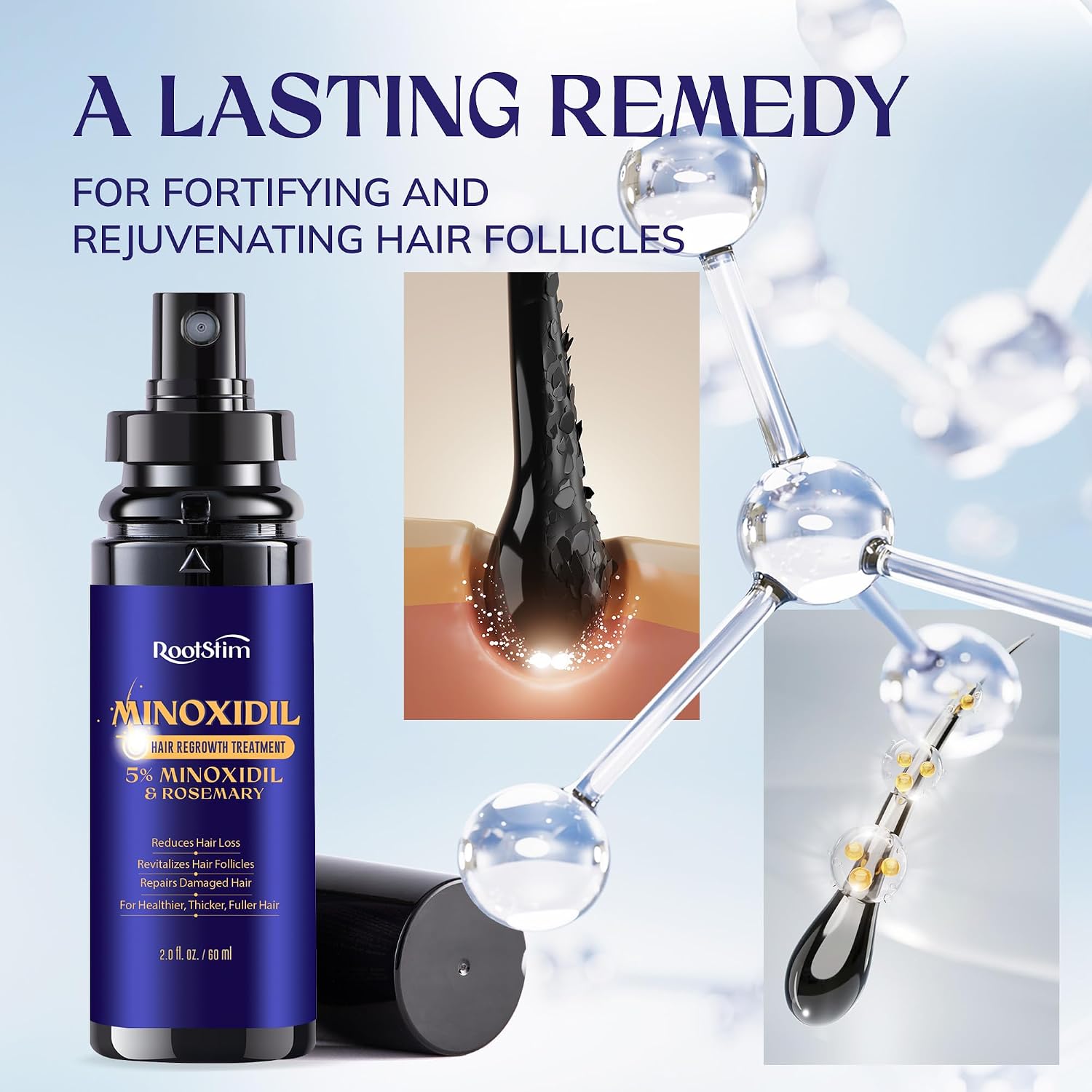 Rootstim Minoxidil 5% Hair Growth Spray For Men And Women | Fast-Drying Lightweight Formula, Thinning Hair Regrowth | Rosemary, Biotin, Caffeine | Daily Use | 2 Fl Oz