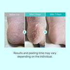 Ariul Smooth & Pure Foot Peel Mask, Nourishing Foot Peeling Socks for Dark, Dull Feet & Dead Skin Removal, Korean Skincare, 2 Pairs (Rice)