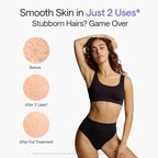 Ulike Laser Hair Removal Device Air 10 Ipl Gift for Women and Men, Ice cool and Permanent hair Reduction for Nearly Painless, Dual Lights, Skin Sensor & USHR Mode Hair Removal in 10mins from Home