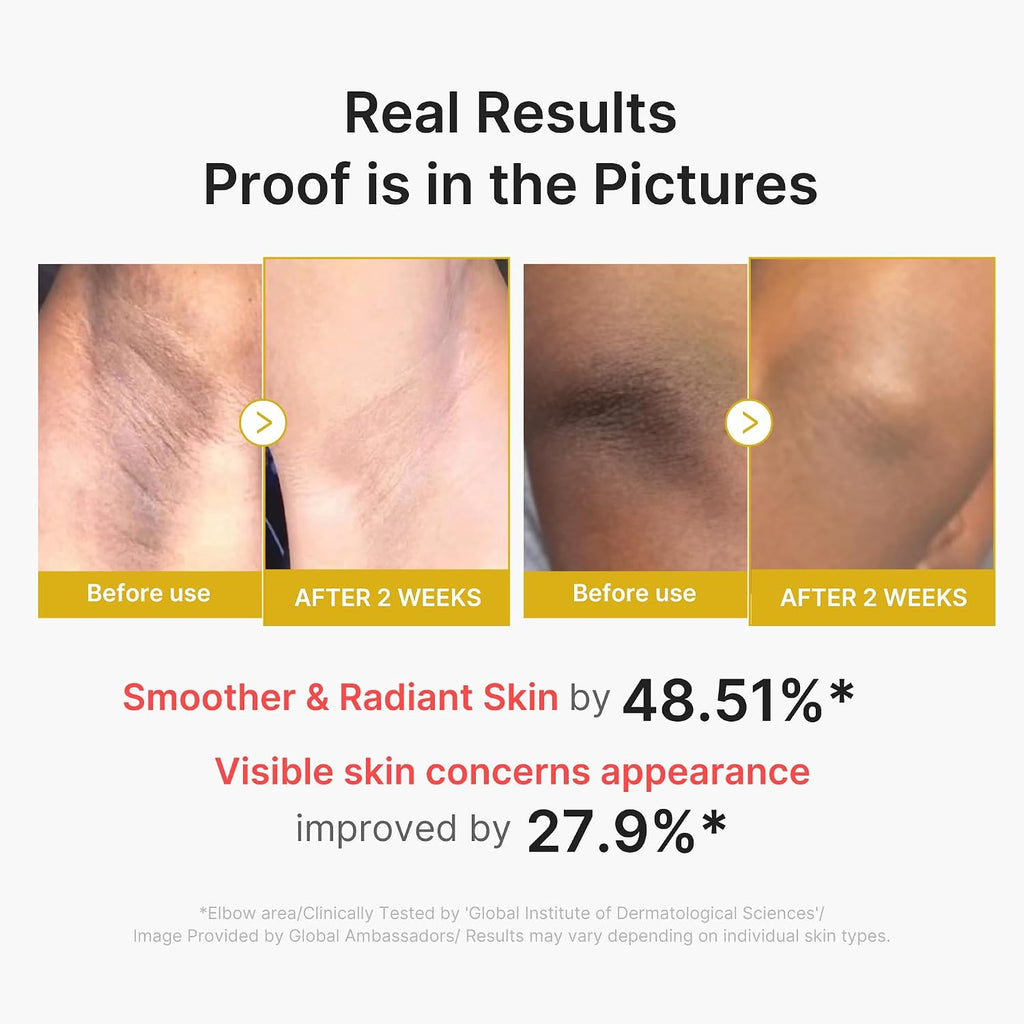 Medicube Body Peel Shot With Kojic Acid And Turmeric | Gentle Body Brightening & Exfoliating Serum With Bha, Lha & Pha For Dead Skin Cells, Uneven Looking Skin & Excess Sebum | 9.46 Fl.Oz