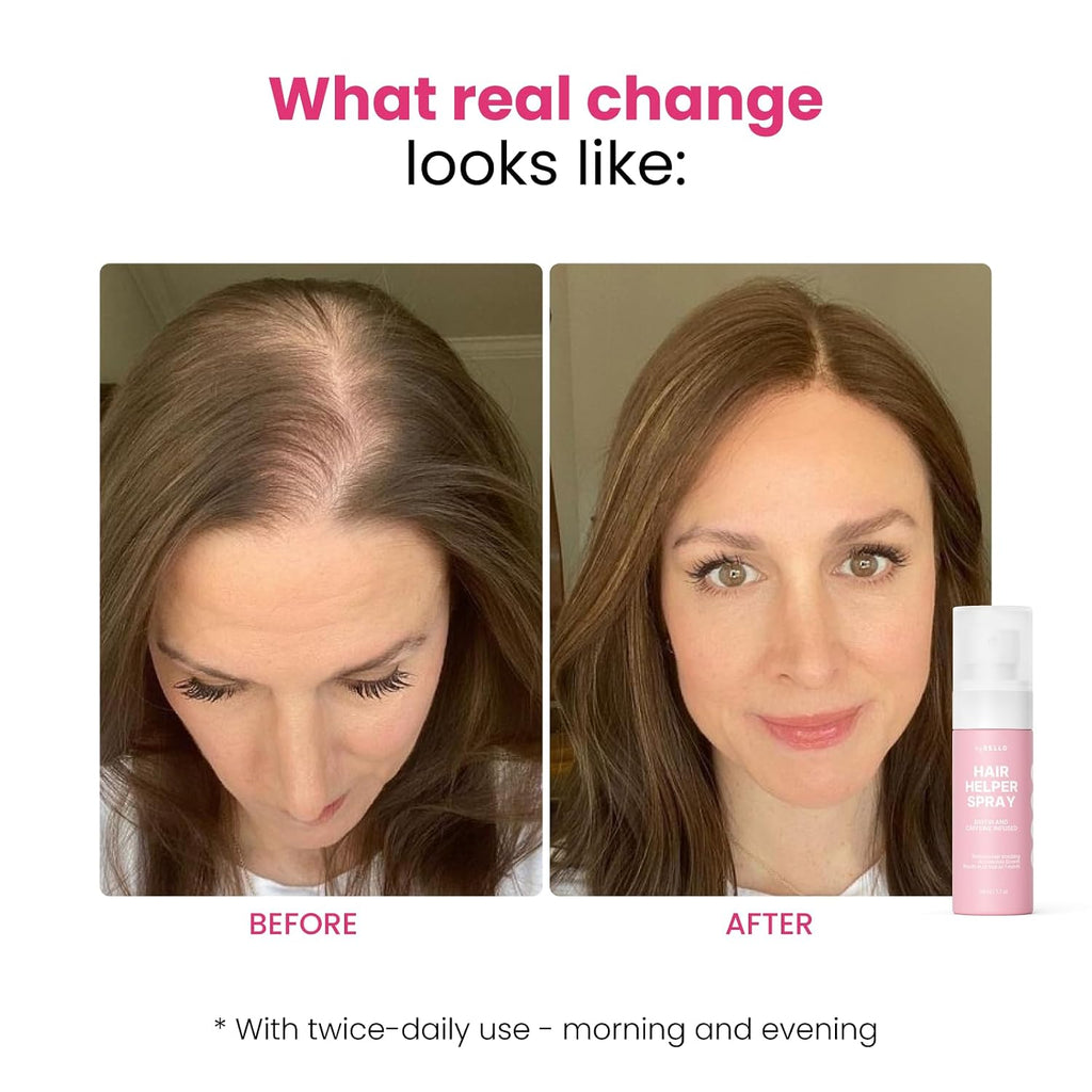 Hair Helper Spray | Dht Blocker Hair Growth Serum With Biotin, Castor Oil & Caffeine | Topical For Thicker, Fuller Strands | Anti Thinning, Vegan, Cruelty-Free Formula