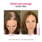 Hair Helper Spray | Dht Blocker Hair Growth Serum With Biotin, Castor Oil & Caffeine | Topical For Thicker, Fuller Strands | Anti Thinning, Vegan, Cruelty-Free Formula