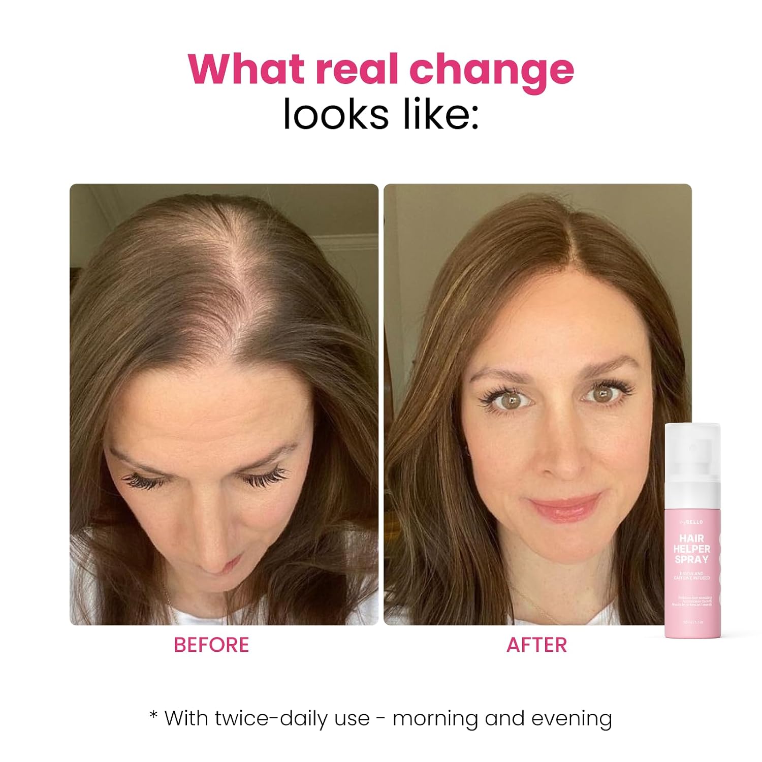 Hair Helper Spray | Dht Blocker Hair Growth Serum With Biotin, Castor Oil & Caffeine | Topical For Thicker, Fuller Strands | Anti Thinning, Vegan, Cruelty-Free Formula