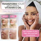 Vitamin E Oil By Leven Rose 75,000 Iu Per Oz 100% Natural, Organic, Pure Vitamin E Oil For Skin, Face, Hair, Nails, And Scars, 4 Oz