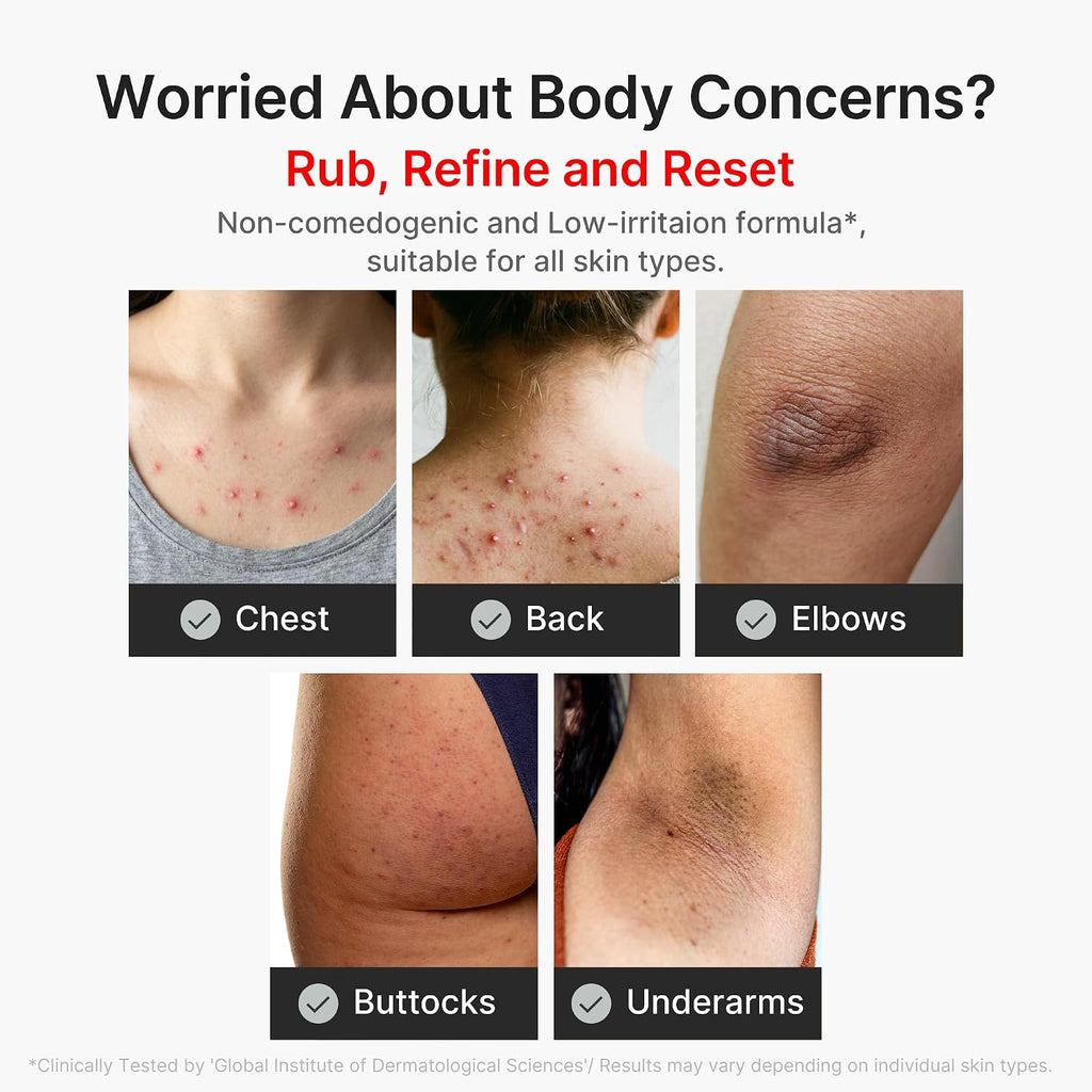Medicube Body Peel Shot With Kojic Acid And Turmeric | Gentle Body Brightening & Exfoliating Serum With Bha, Lha & Pha For Dead Skin Cells, Uneven Looking Skin & Excess Sebum | 9.46 Fl.Oz