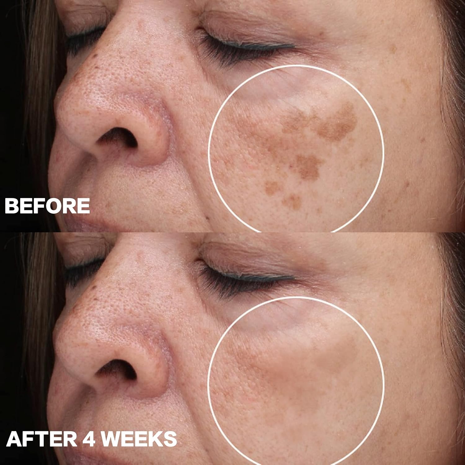 Citygoo Dark Spot Remover For Face: Dark Spot Corrector Cream - Enriching Skin Care For All Skin Tones - Melasma Freckle Sun Spot Remover & Blemish Reducer-1.7 Fl Oz