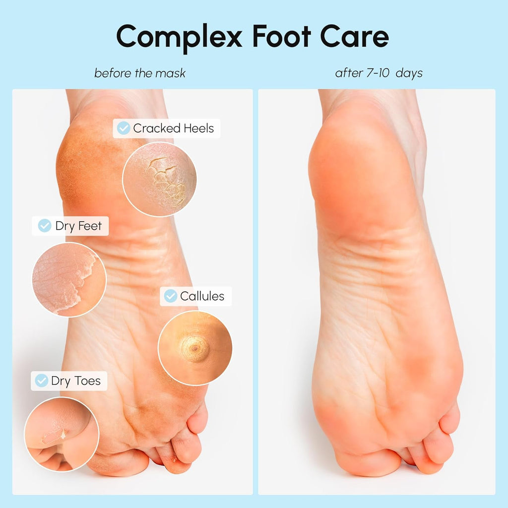 MAREE Foot Peeling Mask – 3-in-1 Foot Mask for Dry Cracked Feet, Callus Remover – Dead Skin Exfoliating Foot Peel Mask with Glycolic Acid – Moisturizing Socks for Men – Spa Self Care Gifts for Women