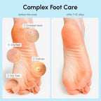 MAREE Foot Peeling Mask – 3-in-1 Foot Mask for Dry Cracked Feet, Callus Remover – Dead Skin Exfoliating Foot Peel Mask with Glycolic Acid – Moisturizing Socks for Men – Spa Self Care Gifts for Women