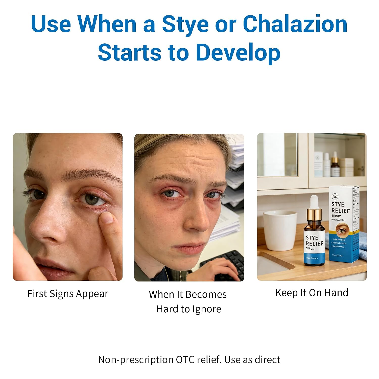 Stye Eye Treatment Product, Relief For Styes, Chalazions, Blepharitis, Dry Eyes, Irritation And Swelling; Clear Eyes Redness Relief, Eye Stye Treatment, Soothing Eyelid Comfort, 30Ml 1 Fl Oz