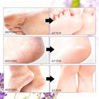 Foot Masks for Dry Cracked Feet, Lavender Moisturizing Socks - Intensive Hydrating Foot Care & Cracked Heel Treatment, 5 Pairs