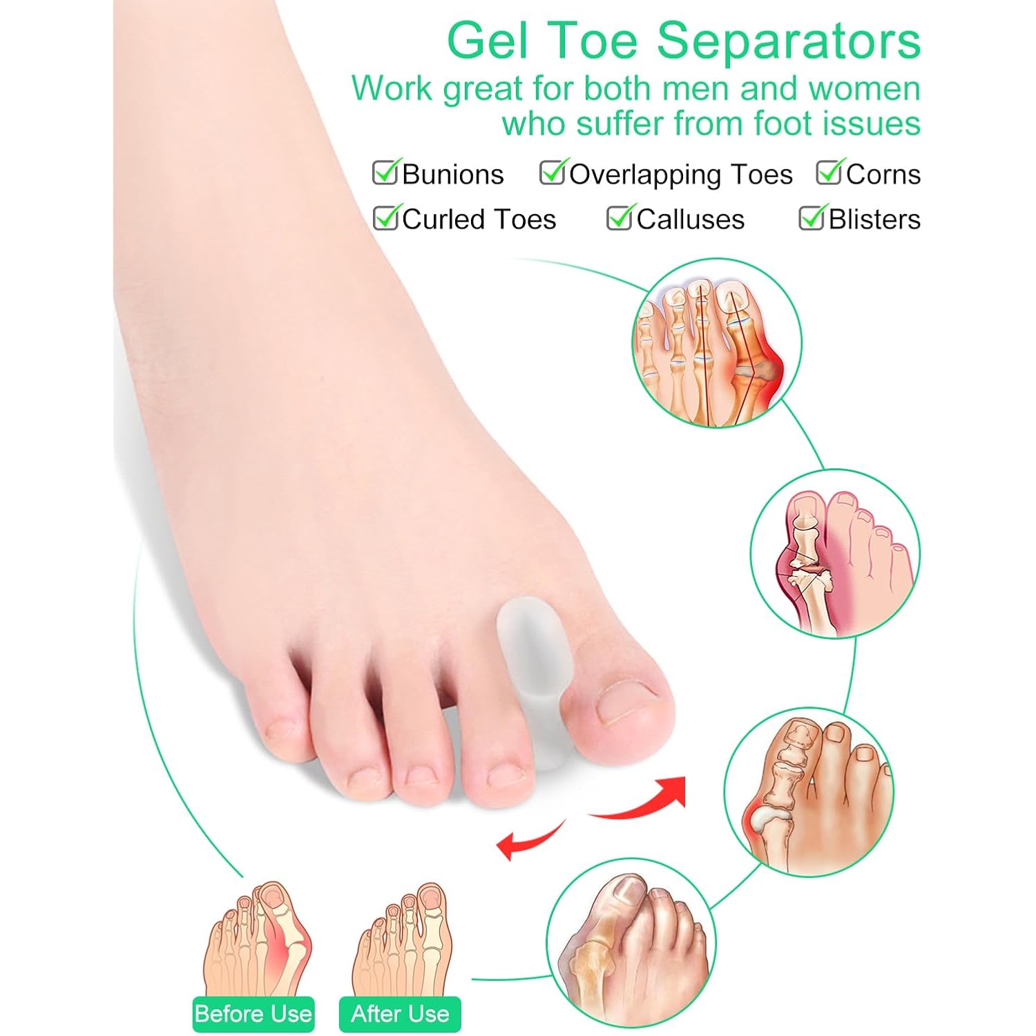 PGRODE 12 Pack Gel Toe Separators Silicone Toe Spacers for Women Men Bunion Corrector Toe Pain Relief, Toe Alignment, Soft Toe Spacer for Crooked Toes, Overlapping Toes, Hammertoe Correction (Large)
