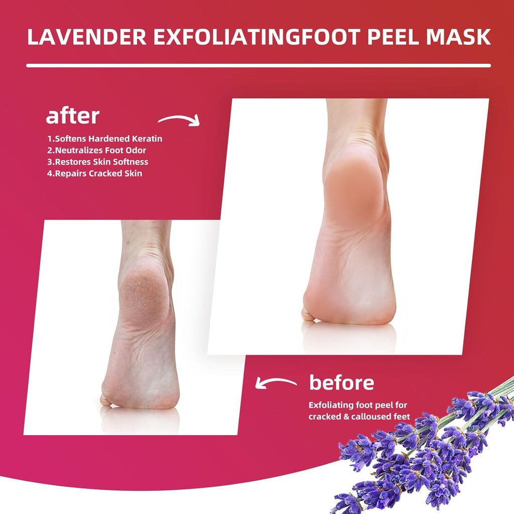Foot Peel Mask for Dry, Rough Feet – Exfoliating Foot Mask with Fruit Acids, Lavender & Urea – Peeling Socks for Dead Skin & Cracked Heels – Foot Care for Women & Men
