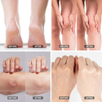 ASDToTio Urea Cream 42% - Foot Care for Dry Cracked Heels, Foot Lotion - With 2% Salicylic Acid, Tea Tree Oil, Shea Butter, Aloe Vera - For Feet, Hands, Heels, Elbows, Knees and More - 6 oz