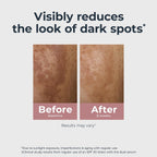 Eucerin Radiant Tone Dual Serum Dark Spot Corrector, Dark Spot Serum With Thiamidol And Hyaluronic Acid, 1 Fl Oz Bottle