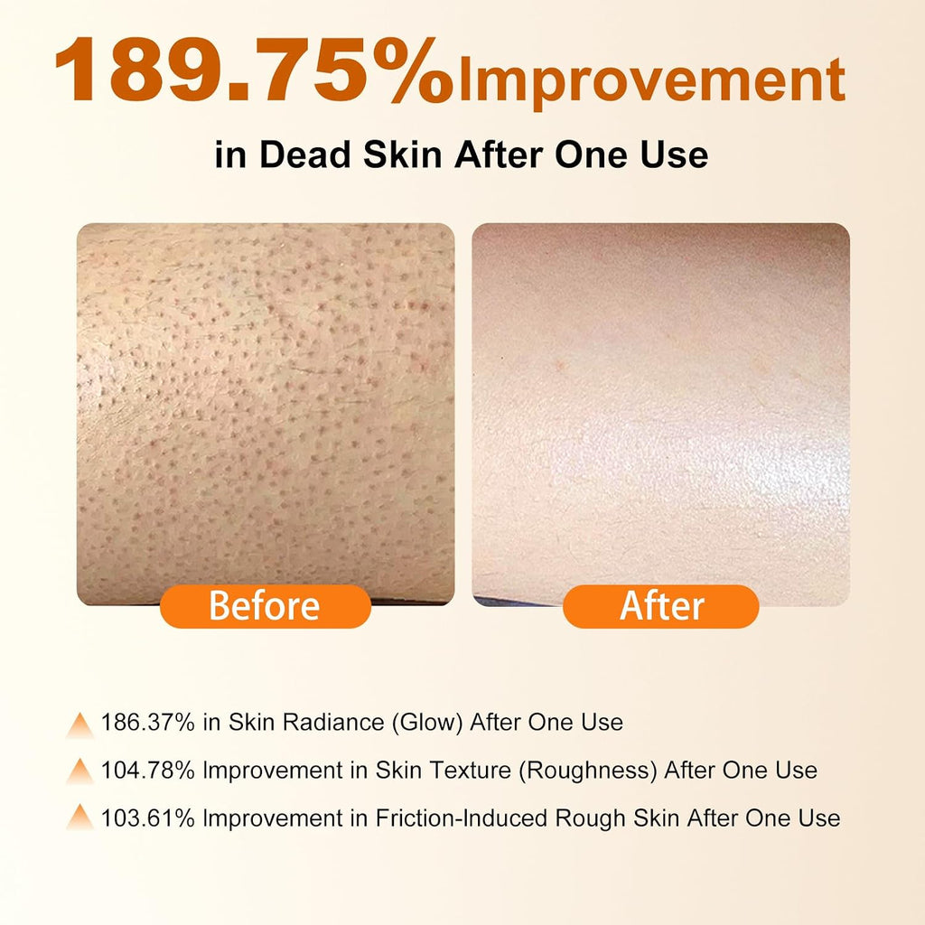 Body Keratin Care Kojic Acid Turmeric Spray: Gentle Body Peel Mist To Help Remove Dead Skin And Improve Rough Texture, Suitable For All Skin Types (2 Pack) -S, 200Ml - A