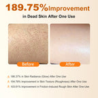 Body Keratin Care Kojic Acid Turmeric Spray: Gentle Body Peel Mist To Help Remove Dead Skin And Improve Rough Texture, Suitable For All Skin Types (2 Pack) -S, 200Ml - A
