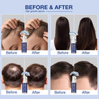 VENANOCI Hair Growth Oil Spray: Natural Hair Regrowth Serum with Rosemary, Biotin – Anti-Hair Loss Treatment for Thinning Hair – Promotes Thicker, Fuller Hair for Women & Men