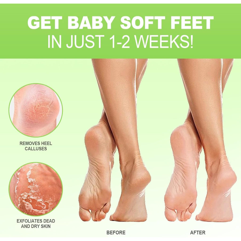 JVR Foot Peel Mask - 3 Pairs - Exfoliating Peeling Callus Remover, Softens Rough, Cracked Heels & Dry Skin, for Smoother and Softer Feet (Aloe Vera)