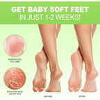 JVR Foot Peel Mask - 3 Pairs - Exfoliating Peeling Callus Remover, Softens Rough, Cracked Heels & Dry Skin, for Smoother and Softer Feet (Aloe Vera)