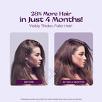 Women's 5% Minoxidil Spray for Hair Growth: 2-Pack RootStim Extra Strength Minoxidil with Rosemary & Biotin for Thinning Hair Regrowth and Fuller Hair - 60ML Each