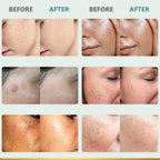 Citygoo Dark Spot Remover For Face: Dark Spot Corrector Cream - Enriching Skin Care For All Skin Tones - Melasma Freckle Sun Spot Remover & Blemish Reducer-1.7 Fl Oz