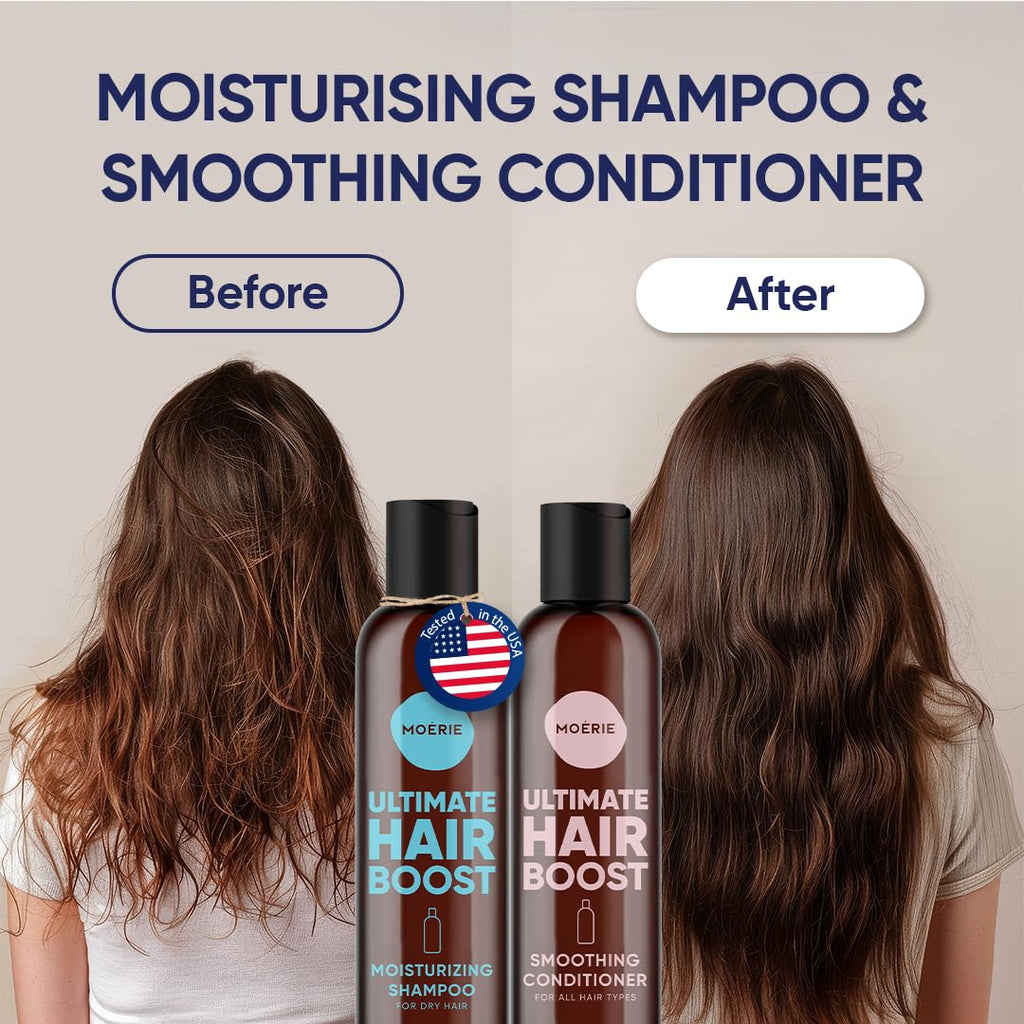 Moerie Ultimate Hair Growth Shampoo & Conditioner Set – Longer, Thicker, Fuller Hair – Vegan, Volumizing, Paraben & Silicone Free – Moisturizing For All Hair Types – 2 X 8.45 Fl Oz (250Ml)