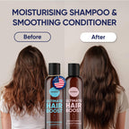 Moerie Ultimate Hair Growth Shampoo & Conditioner Set – Longer, Thicker, Fuller Hair – Vegan, Volumizing, Paraben & Silicone Free – Moisturizing For All Hair Types – 2 X 8.45 Fl Oz (250Ml)