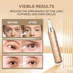 Ronkie Eye Cream For Dark Circles: Under Eye Cream With Retinol Caffeine - Reduces Under Eye Bags And Fine Lines (Gold, 15Ml)