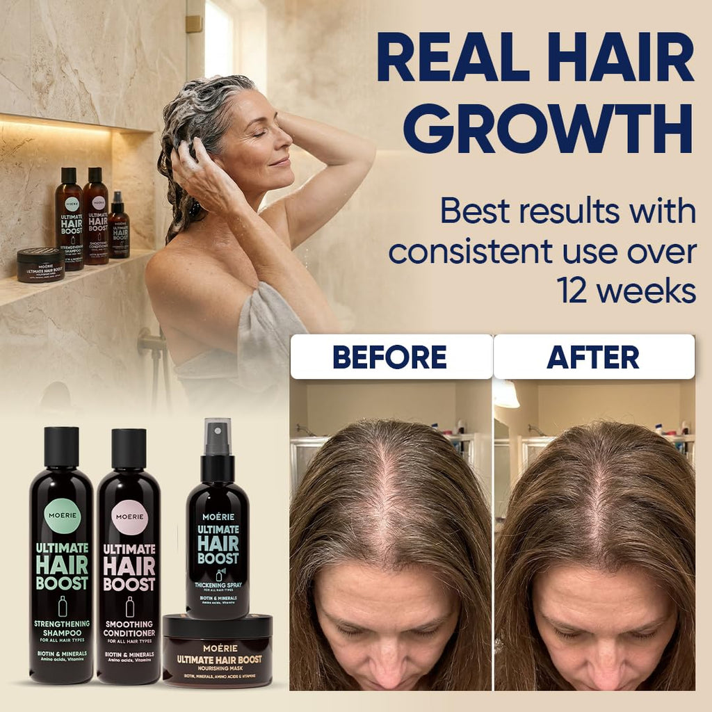 Moérie Hair Growth Shampoo, Conditioner, Spray And Mask For Men And Women, Hair Loss Solution With Biotin And Rosemary, Thickening Hair Regrowth Set With Serum Level Care For Thinning Hair, 4 Set