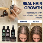 Moérie Hair Growth Shampoo, Conditioner, Spray And Mask For Men And Women, Hair Loss Solution With Biotin And Rosemary, Thickening Hair Regrowth Set With Serum Level Care For Thinning Hair, 4 Set