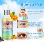 Stye Relief Serum & Eyelid Drops For Blepharitis & Chalazion | Natural Fast-Acting Formula For Lash Line & Under Eye | Gentle Cleansing Care 1.01 Fl Oz (Pack Of 1)