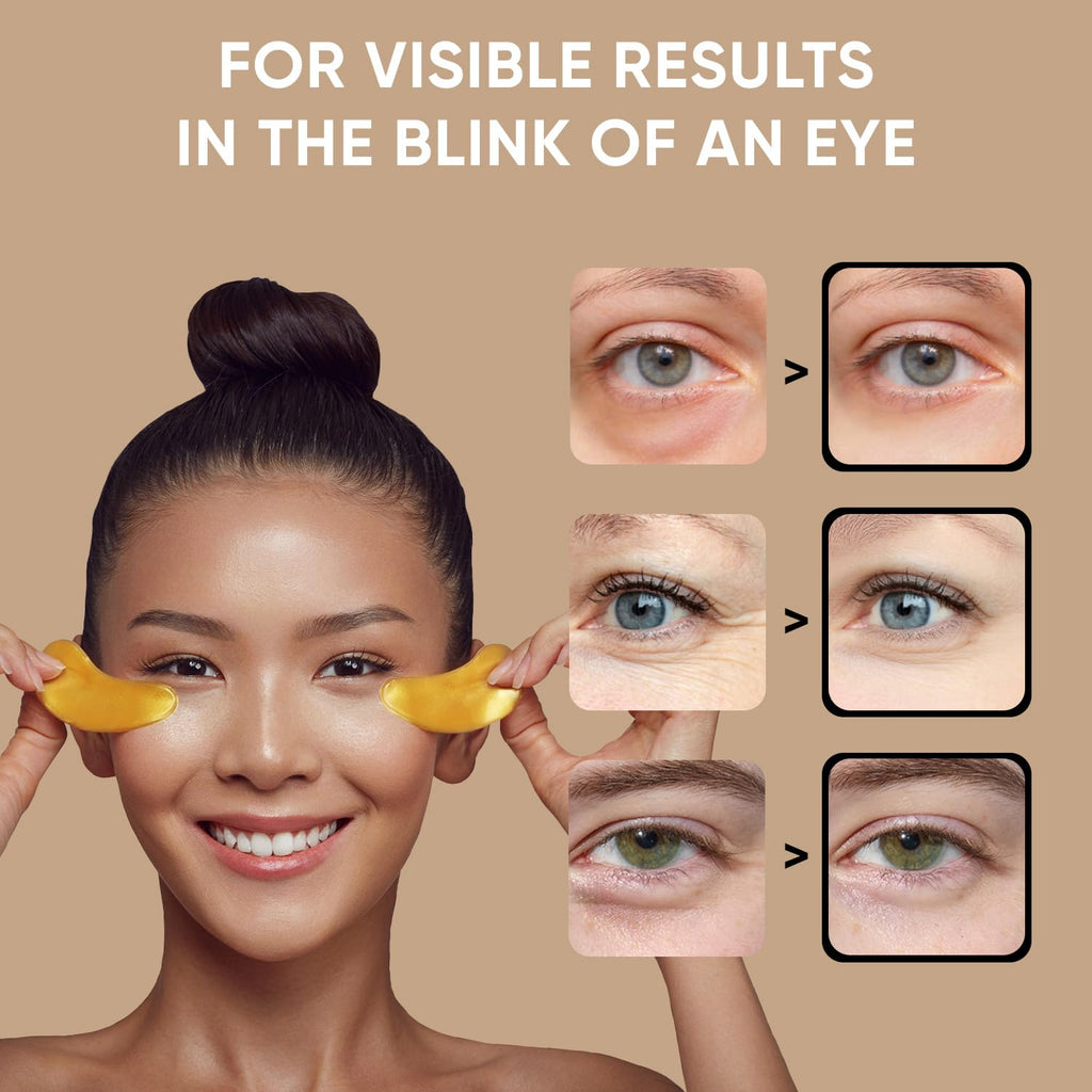 Under Eye Patches (20 Pairs) - Eye Patches For Puffy Eyes And Dark Circles - Under Eye Mask For Beauty & Personal Care - Under Eye Mask Amino Acid & Collagen For Dark Circles And Puffiness By Celor