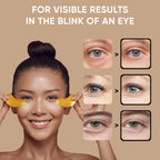 Under Eye Patches (20 Pairs) - Eye Patches For Puffy Eyes And Dark Circles - Under Eye Mask For Beauty & Personal Care - Under Eye Mask Amino Acid & Collagen For Dark Circles And Puffiness By Celor