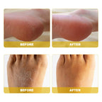 Instant Foot Peeling Spray- Coconut Foot Peeling Spray Instantly Remove Dead Skin, Hydrate & Nourish. Exfoliate Dry, Rough Skin- 4 fl.oz