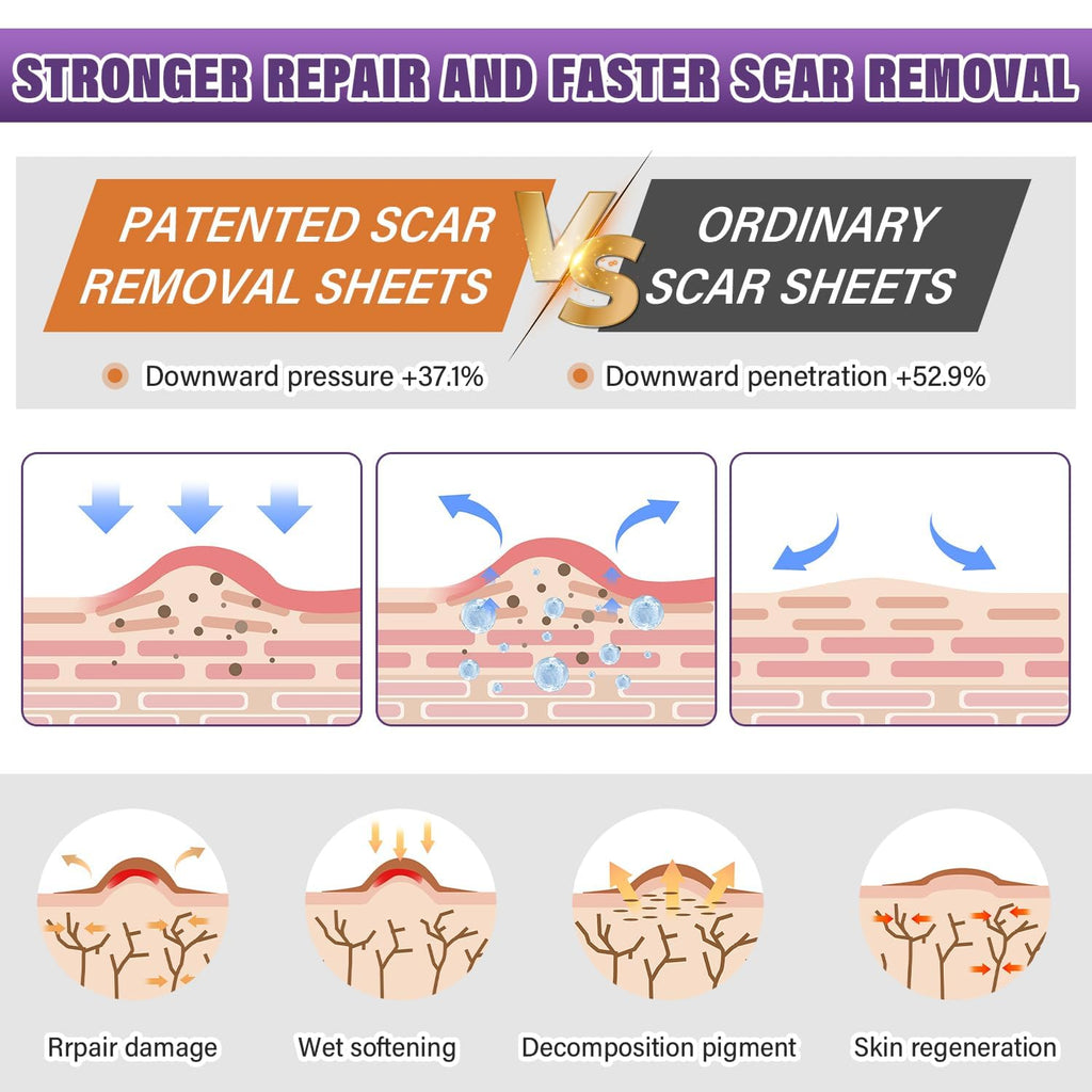 Silicone Scar Sheets, Medical Grade Silicone Scar Tape For Surgical, Hypertrophic, Keloid, C-Section, Burn, Old & New Scars, Reusable Professional Scars Removal Sheets (1.6"X 59" Roll-1.5M)