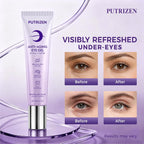 Retinol Under Eye Serum With Caffeine & Collagen, For Puffy Eye Bags & Dark Circles, Fine Lines & Wrinkles, Dermatologist-Tested, Fast-Absorbing & Moisturizing Eye Serum