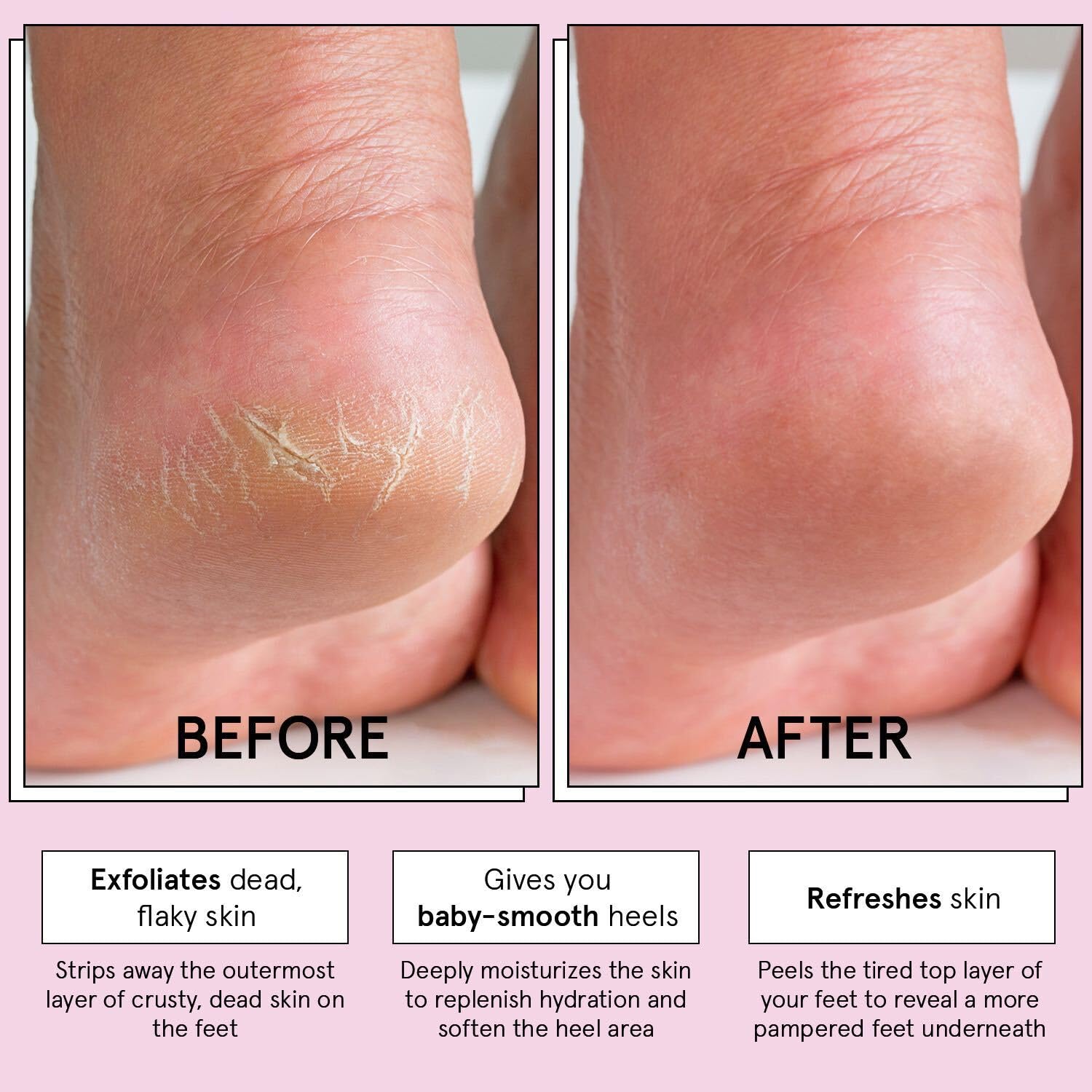 grace & stella Award-Winning Foot Peel Mask - Foot Peeling Mask with Aloe Vera - Moisturizing Foot Mask for Dry Cracked Feet - Foot Exfoliator for Baby Soft Feet (4 Pairs, Unscented)