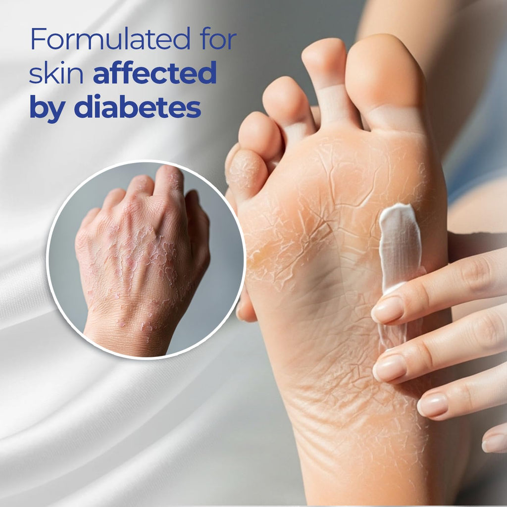 Goicoechea Diabet Tx Diabetic Lotion With Urea For Dry Skin | Soothing Hydrating Cream With Aloe, Oatmeal & Vitamin E For Hands, Elbows, Feet & Body | Extra Dry Skin Support, 13.5 Oz | 1-Pack