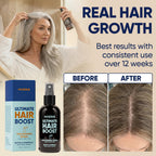 Moerie Hair Growth Serum Spray for Men and Women, Hair Loss Solution with Biotin and Rosemary, Thickening Serum for Hair Regrowth and Thinning Hair - Ultimate Scalp and Growth Care