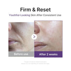 Medicube Retinol Boosting Serum | Intensive Firming, Hydration & Plumping Care With Retinol, Peptides & Vitamins | Pore-Refining, Smooth Radiant Skin | Korean Skincare, 1.01 Fl. Oz